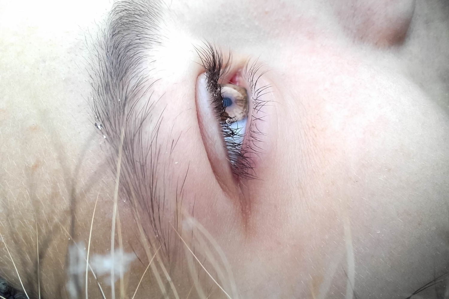 oculari-allergie